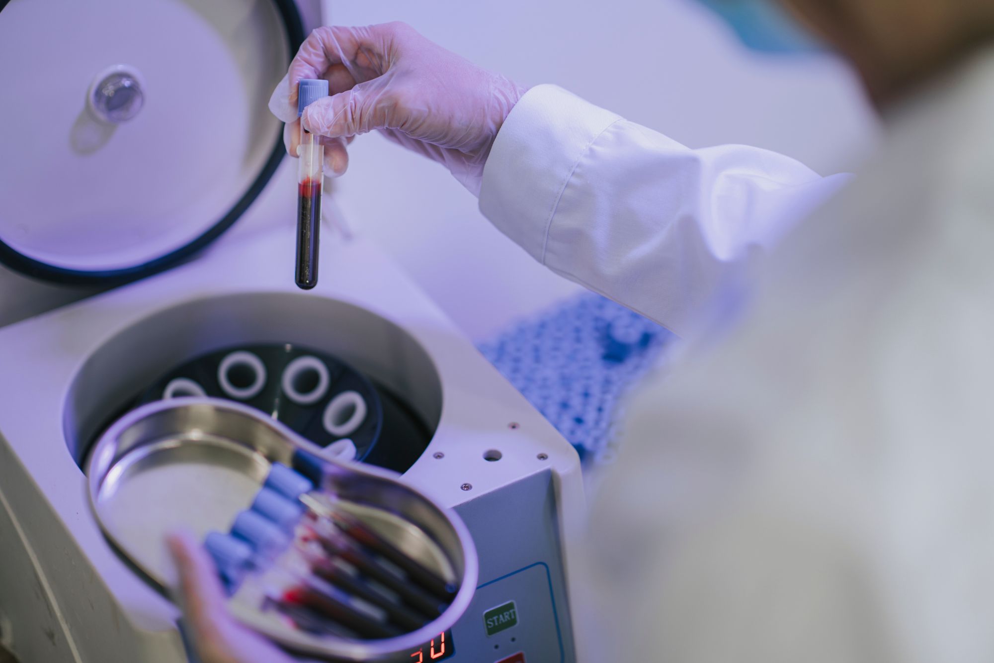 Plasma Therapy image